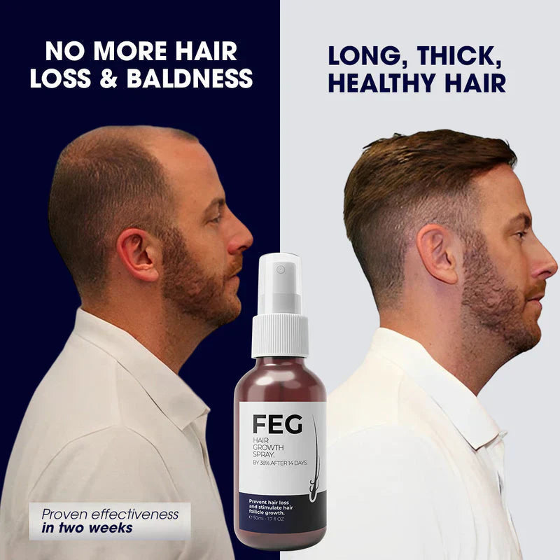 FEG Plus Hair Growth Spray رذاذ نمو الشعر من