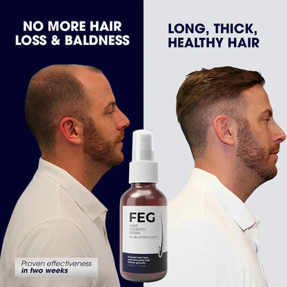 FEG Plus Hair Growth Spray رذاذ نمو الشعر من